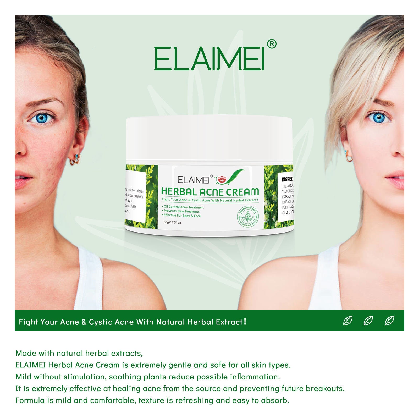 Elaimei™ Herbal Acne Cream